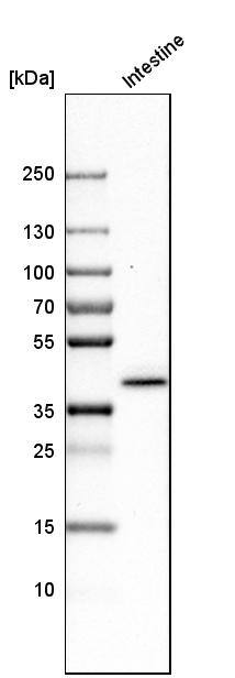 Analysis in human small intestine tissue.
