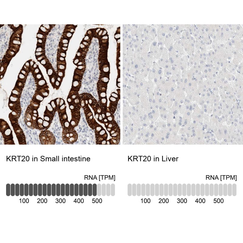 Immunohistochemistry analysis in human small intestine and liver tissues using HPA024309 antibody. Corresponding KRT20 RNA-seq data are presented for the same tissues.