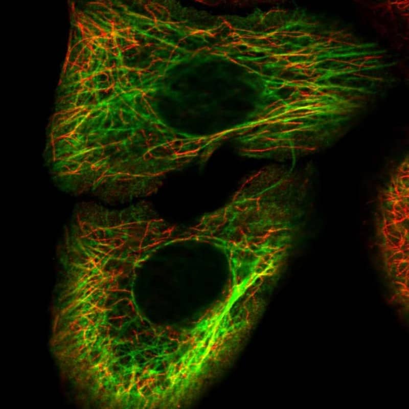 Staining of human cell line HaCaT shows localization to intermediate filaments.