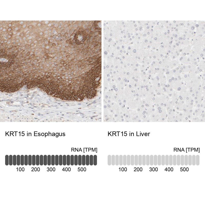 Immunohistochemistry analysis in human esophagus and liver tissues using HPA023910 antibody. Corresponding KRT15 RNA-seq data are presented for the same tissues.