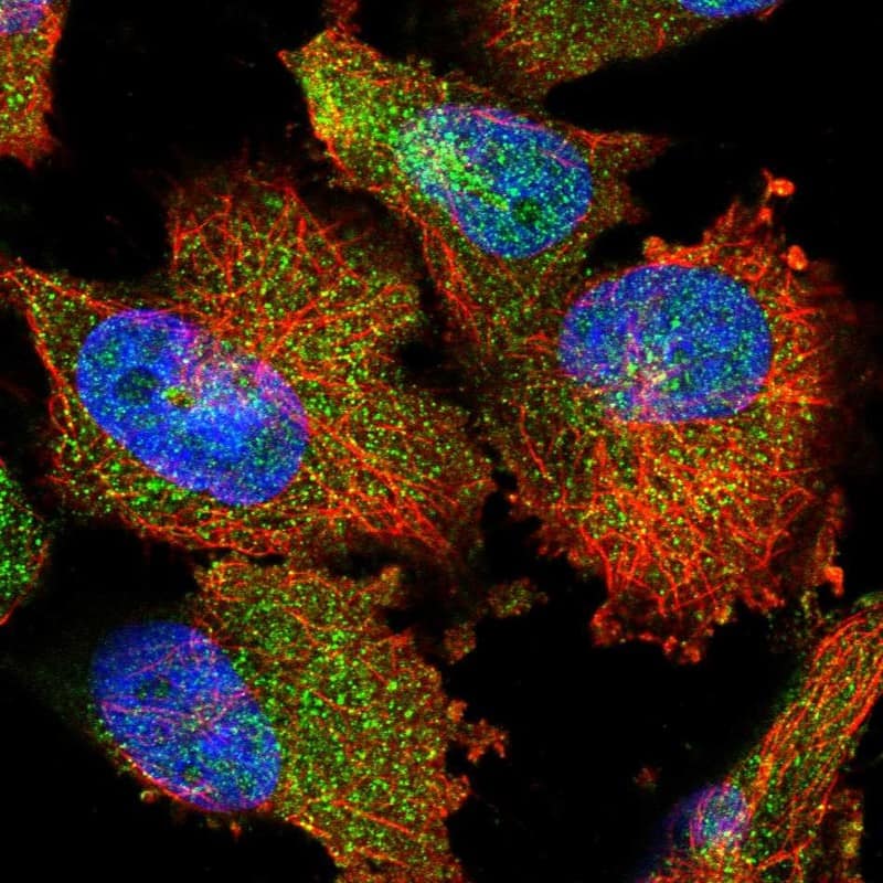 Staining of human cell line U-251 MG shows localization to nucleus, cytosol & vesicles.