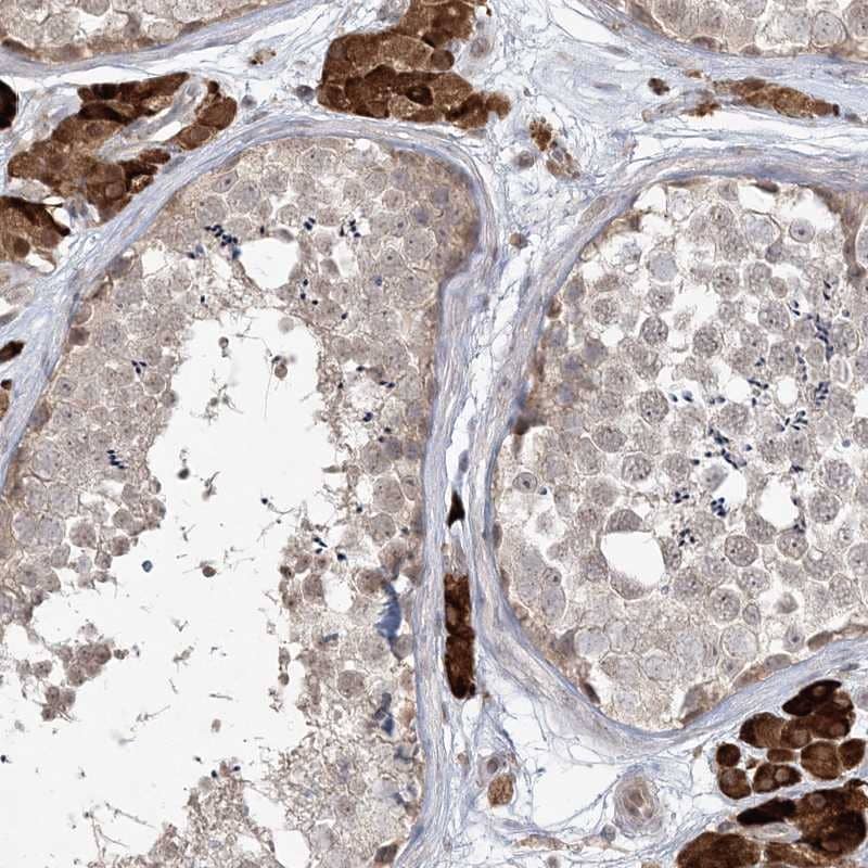 Immunohistochemistry-Paraffin CARD6 Antibody - BSA Free