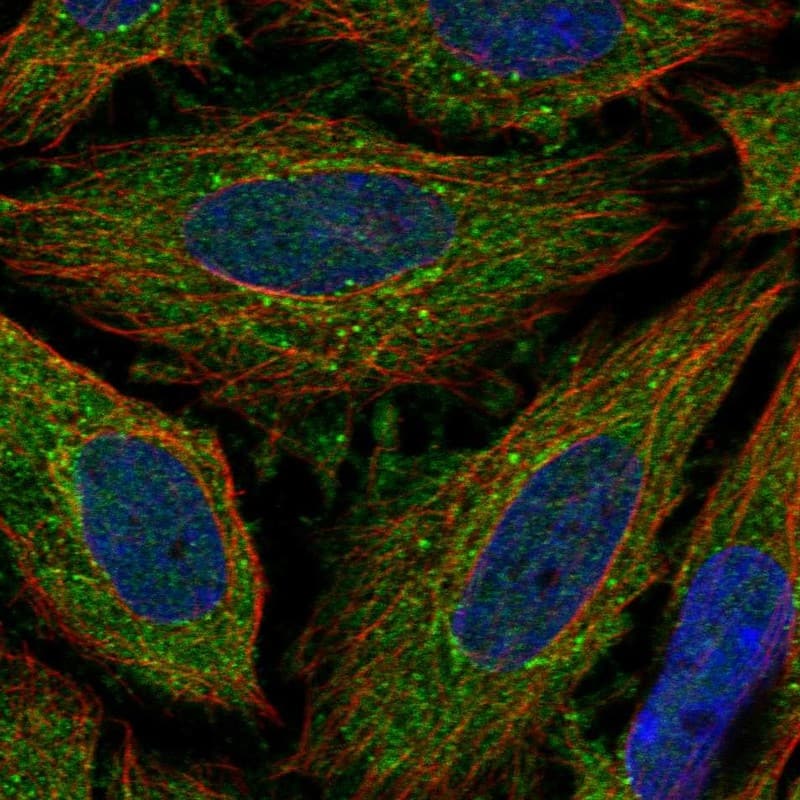 Immunocytochemistry/ Immunofluorescence ELOVL3 Antibody - BSA Free