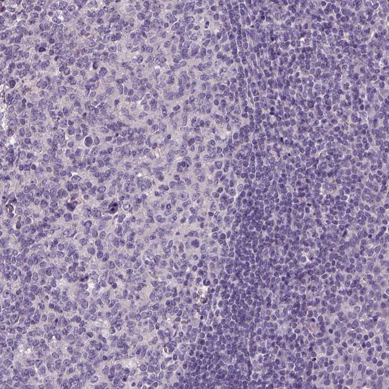 Staining of human tonsil shows no positivity in non-germinal center cells as expected.