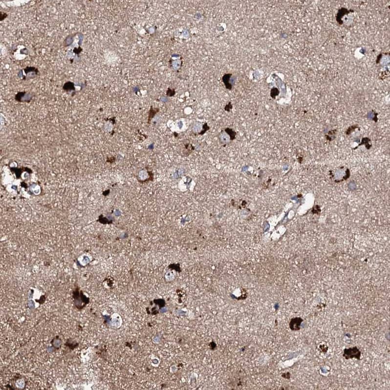 Staining of human cerebral cortex shows strong cytoplasmic positivity in neurons.