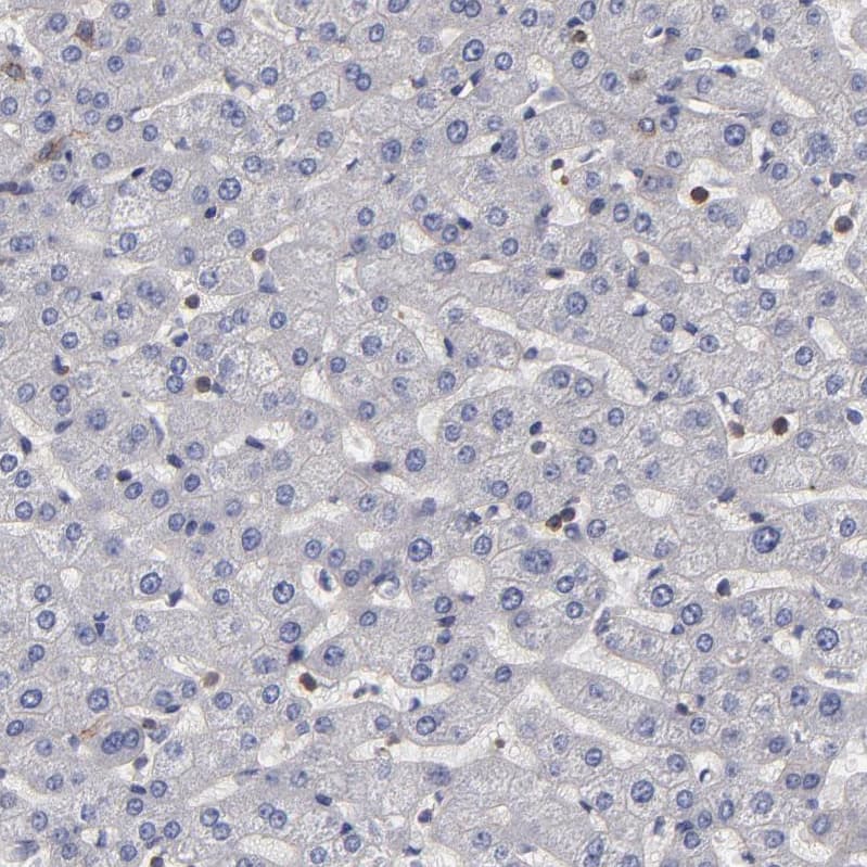Staining of human liver shows no cytoplasmic positivity in hepatocytes as expected.