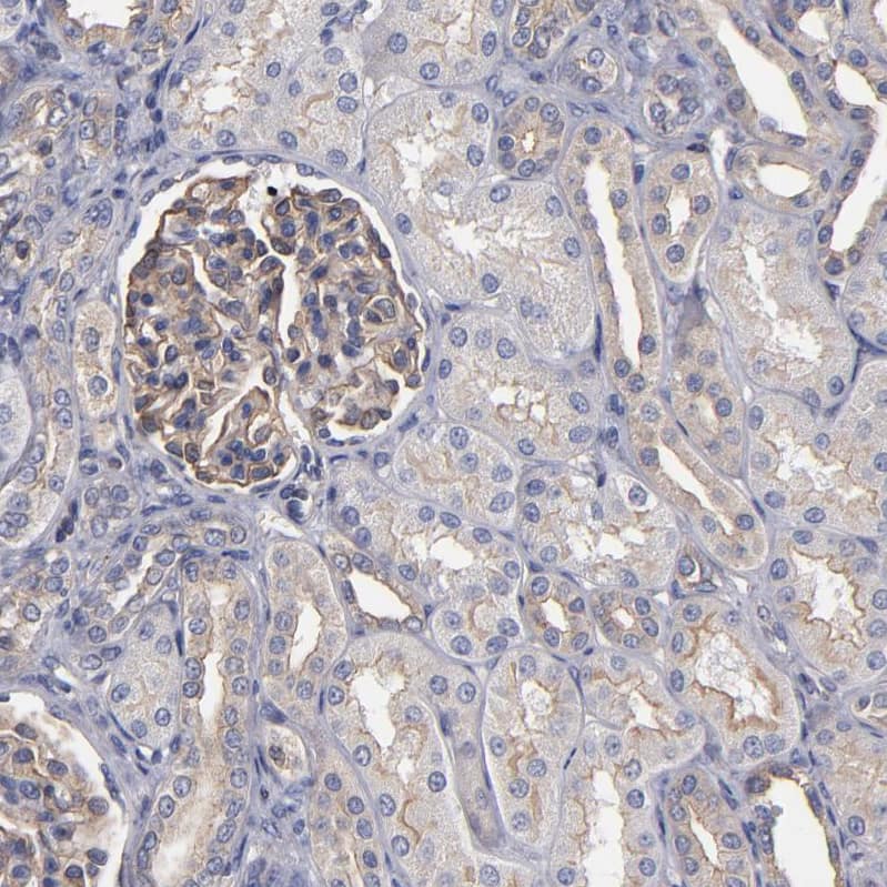 Staining of human kidney shows moderate membranous positivity in cells in glomeruli and tubules.