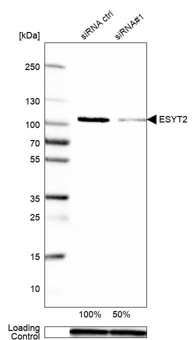<b>Genetic Strategies Validation. </b>Analysis in MCF-7 cells transfected with control siRNA, target specific siRNA probe #1, using Anti-ESYT2 antibody. Remaining relative intensity is presented. Loading control: Anti-GAPDH.