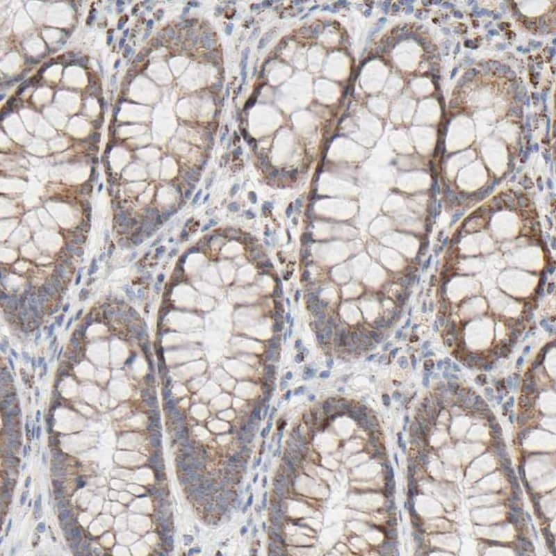 Staining of human rectum shows moderate cytoplasmic positivity in glandular cells.