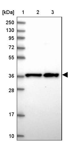 Lane 1: Marker [kDa] 250, 130, 95, 72, 55, 36, 28, 17, 10Lane 2: Human cell line RT-4Lane 3: Human cell line U-251MG sp