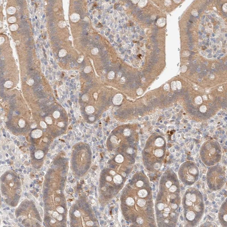 Staining of human gastrointestinal shows moderate cytoplasmic positivity in glandular cells.