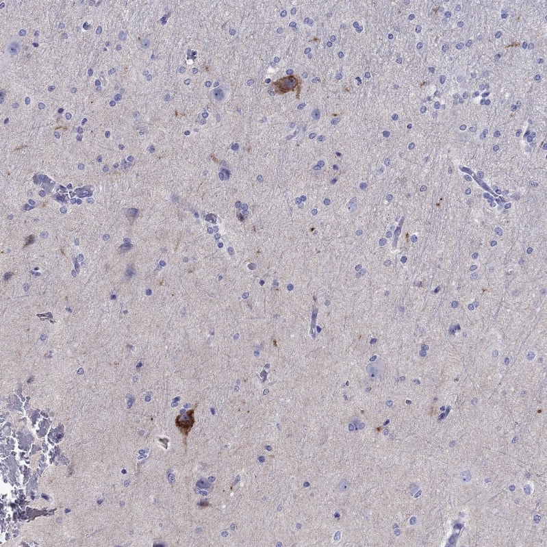 Immunohistochemistry-Paraffin Chromogranin C Antibody - BSA Free