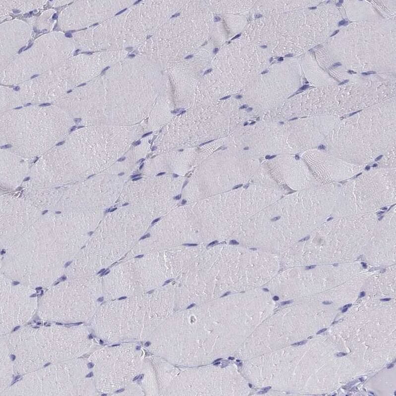 Staining of human skeletal muscle shows no cytoplasmic positivity in endocrine glandular cells as expected.