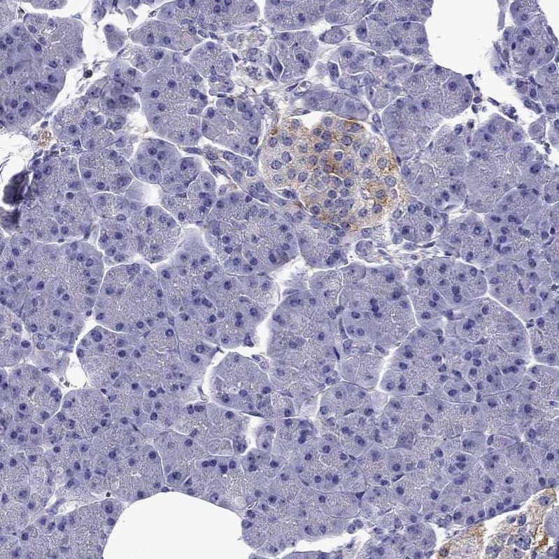 Staining of human pancreas shows moderate cytoplasmic positivity in endocrine glandular cells.