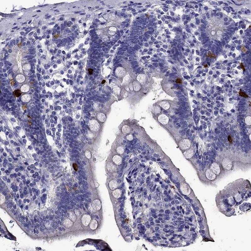 Staining of human duodenum shows strong cytoplasmic positivity in endocrine glandular cells.