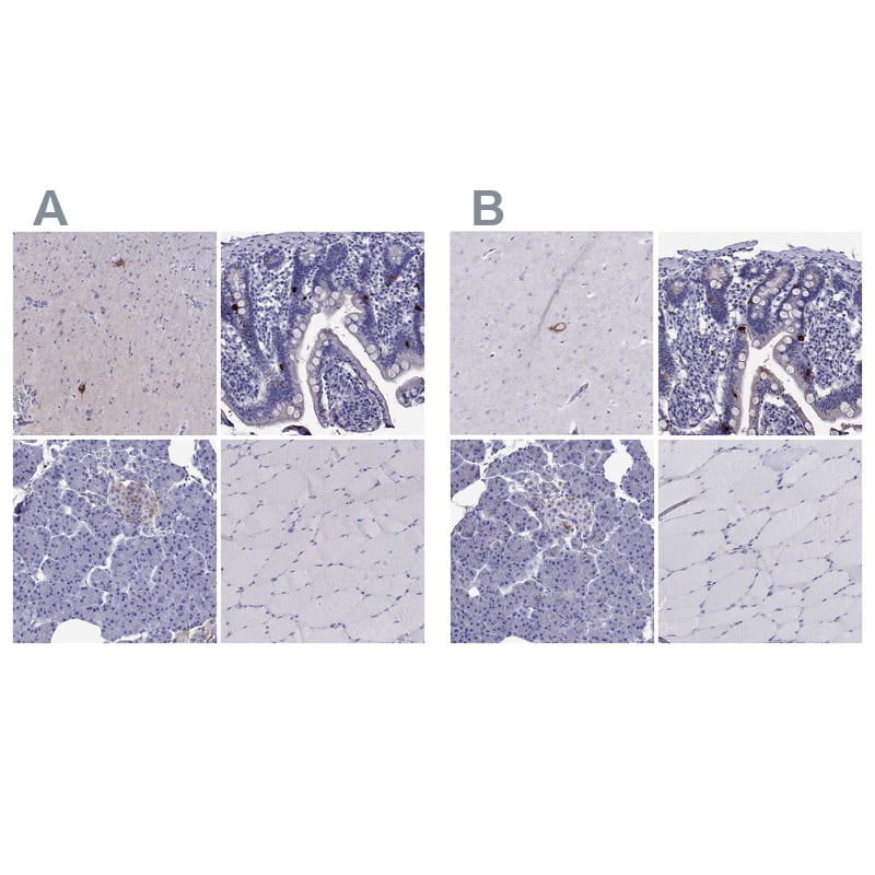 <b>Independent Antibodies Validation. </b>Staining of human cerebral cortex, duodenum, pancreas and skeletal muscle using Anti-SCG2 antibody NBP1-85631 (A) shows similar protein distribution across tissues to independent antibody NBP2-62693 (B).