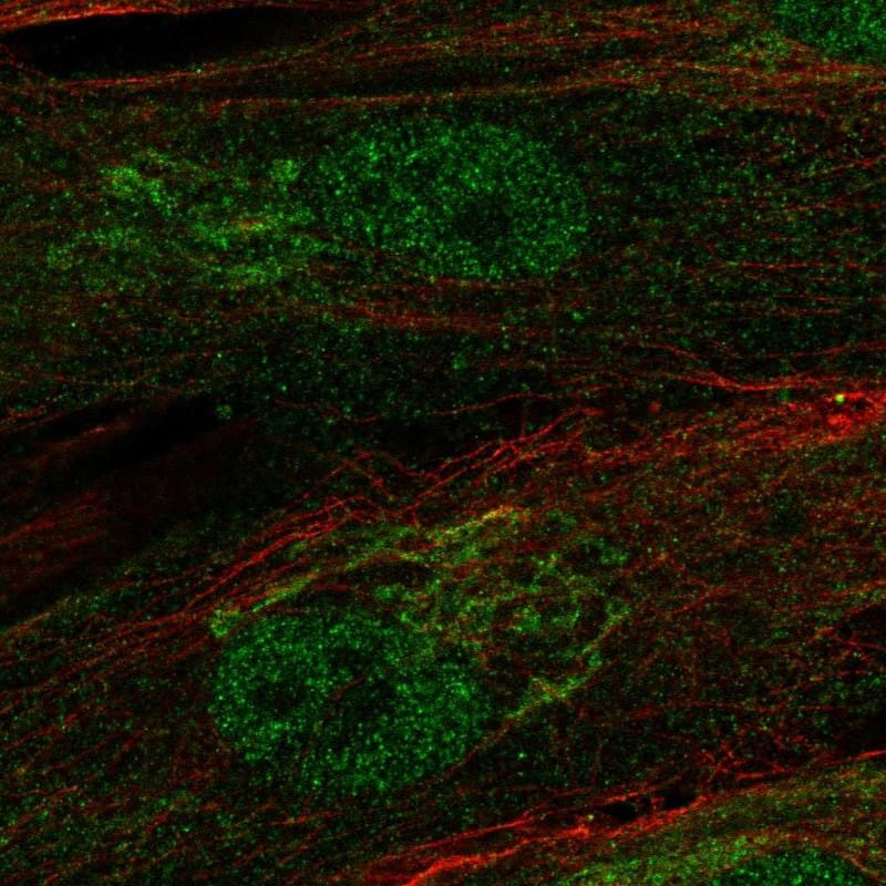 Immunocytochemistry/ Immunofluorescence RCBTB2 Antibody - BSA Free