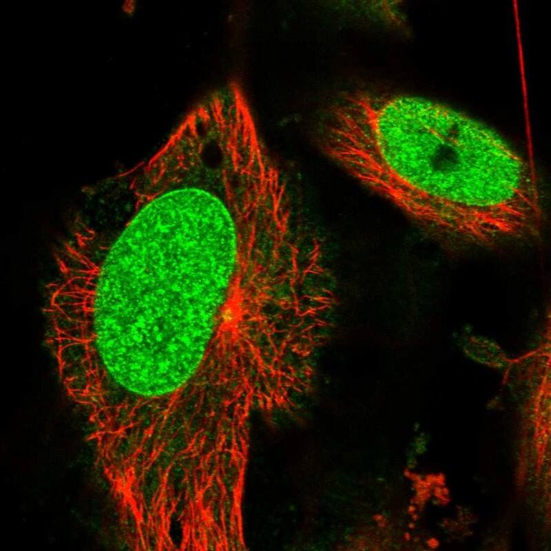 Immunocytochemistry/ Immunofluorescence RCC1 Antibody - BSA Free