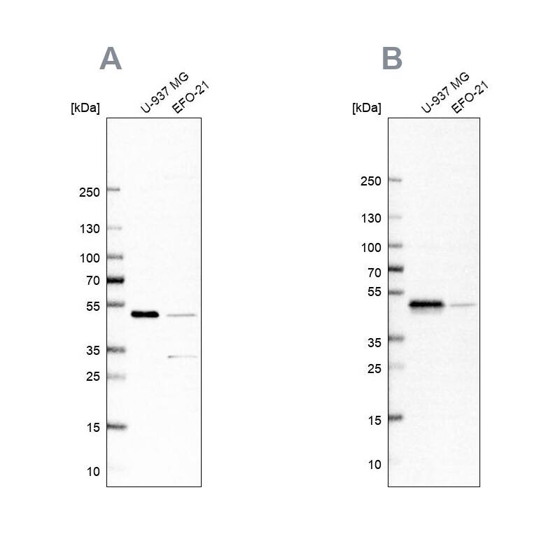 <b>Independent Antibodies Validation. </b>Analysis using Anti-RCC1 antibody NBP1-85637 (A) shows similar pattern to independent antibody NBP1-85638 (B).