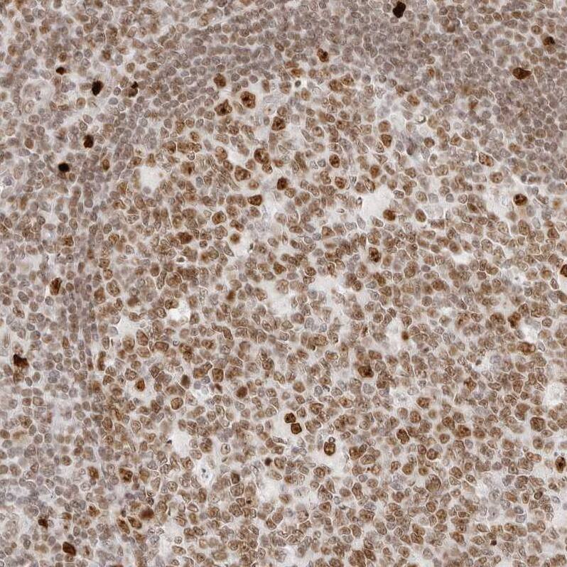 Staining of human tonsil shows strong nuclear positivity in germinal and non-germinal center cells.