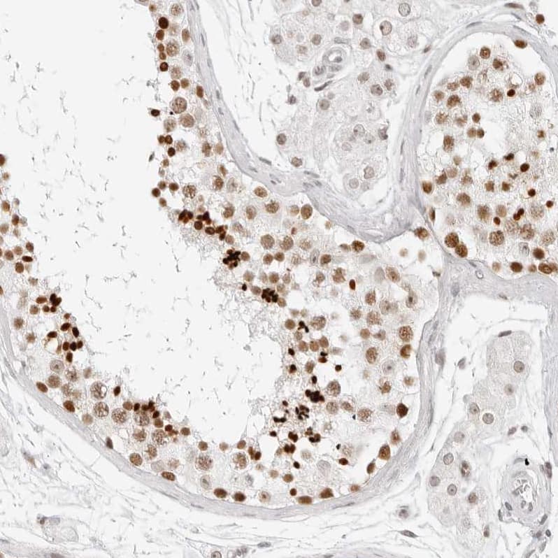 Staining of human testis shows strong nuclear positivity in cells in seminiferous ducts.