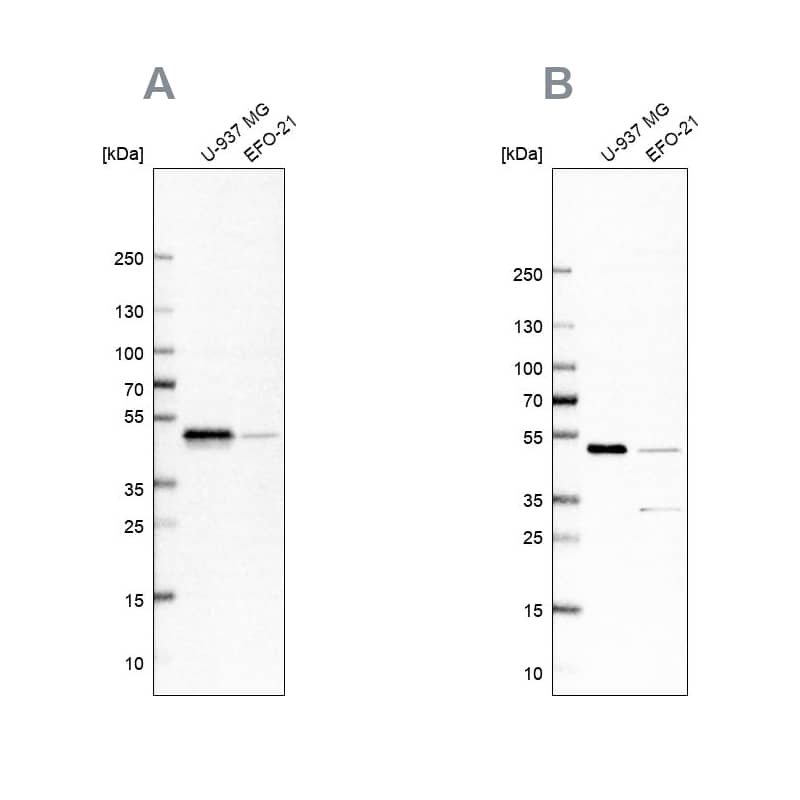 <b>Independent Antibodies Validation. </b>Analysis using Anti-RCC1 antibody NBP1-85638 (A) shows similar pattern to independent antibody NBP1-85637 (B).