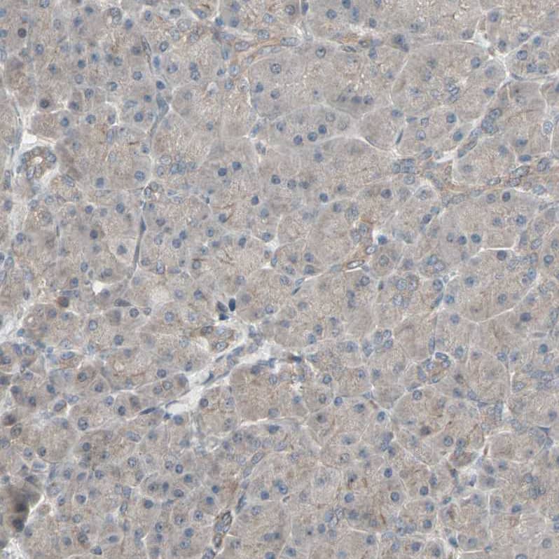 Staining of human Pancreas shows no membranous positivity in exocrine glandular cells.