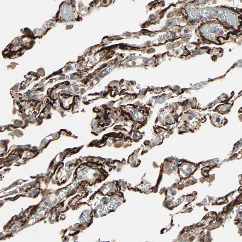 Staining of human Lung shows strong membranous positivity in pneumocytes.