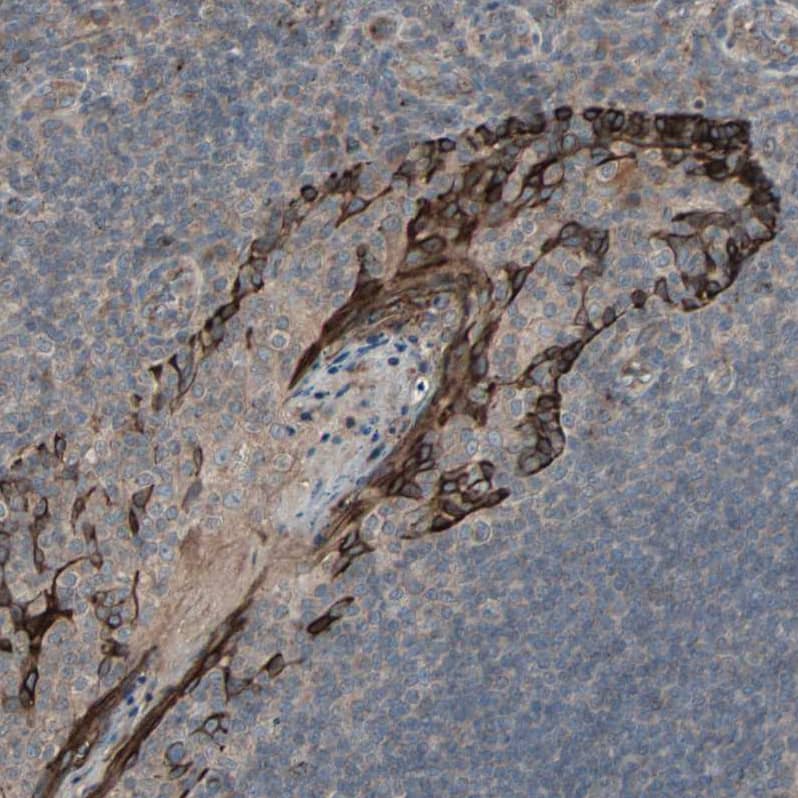 Staining of human Tonsil shows strong membranous positivity in squamous epithelial cells.