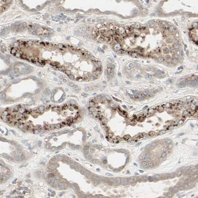 Staining of human Kidney shows moderate granular cytoplasmic positivity in cells in distal tubules.