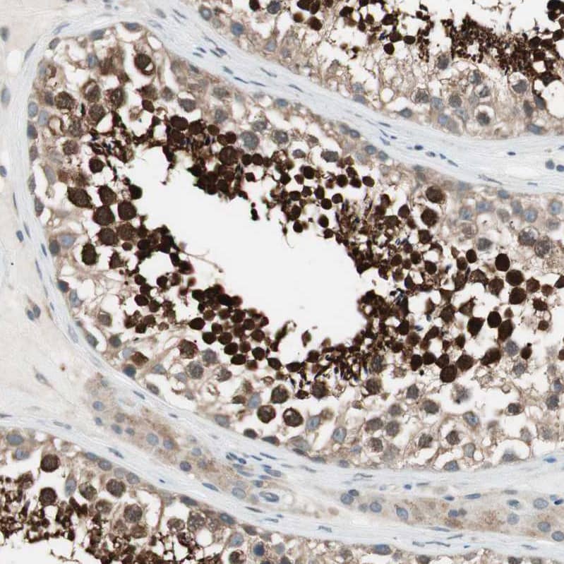 Immunohistochemistry-Paraffin CGR19 Antibody - BSA Free