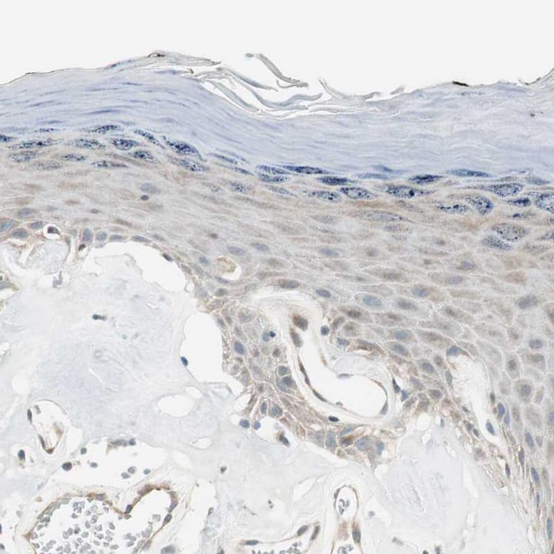 Immunohistochemistry-Paraffin CGR19 Antibody - BSA Free