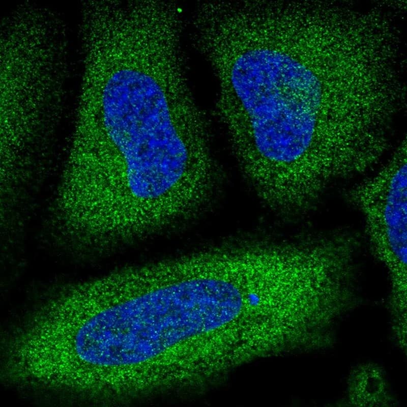 Staining of human cell line HeLa shows localization to cytosol.