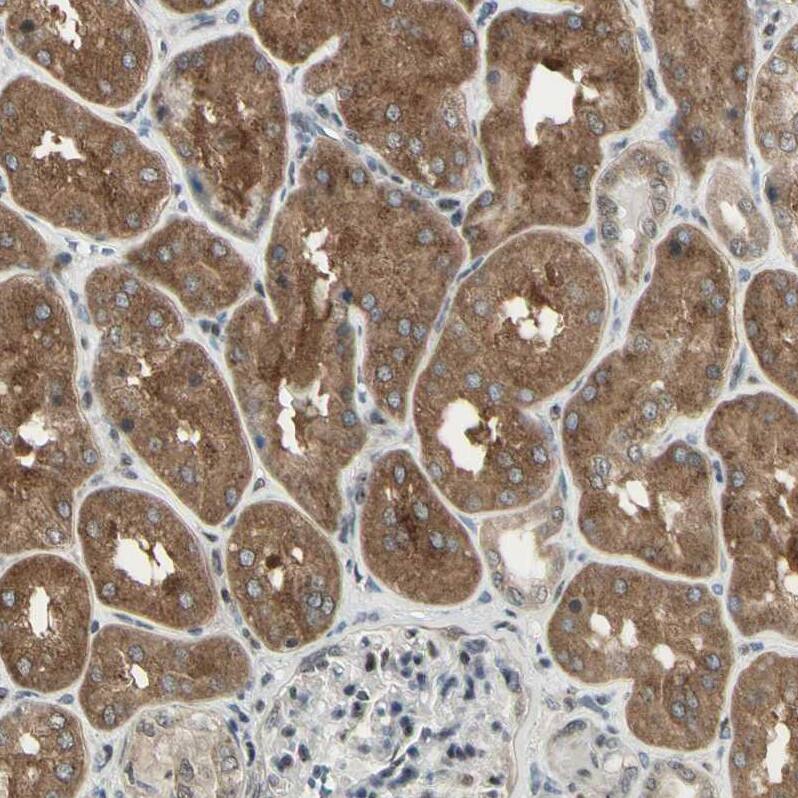 Staining of human kidney shows strong cytoplasmic positivity in cells in tubules.