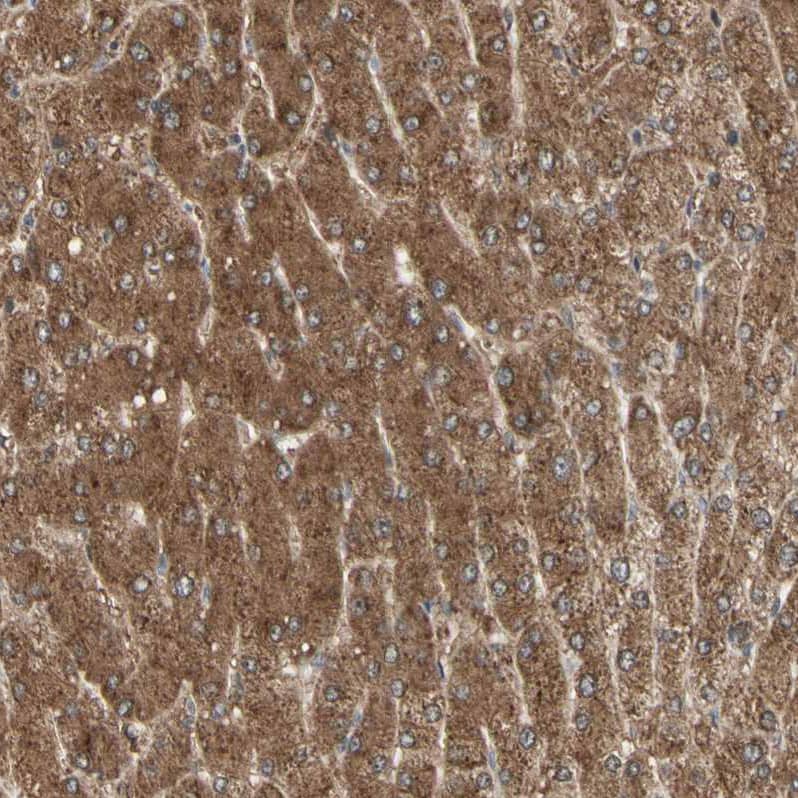 Staining of human liver shows strong cytoplasmic positivity in hepatocytes.