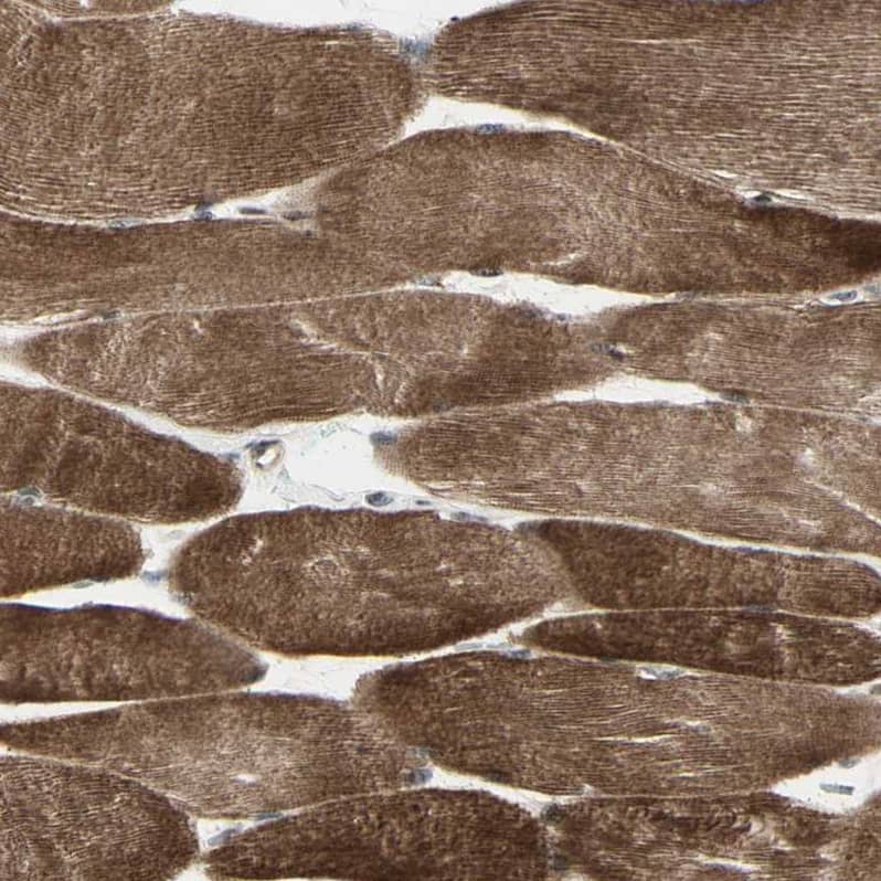 Staining of human skeletal muscle shows strong cytoplasmic positivity in myocytes.