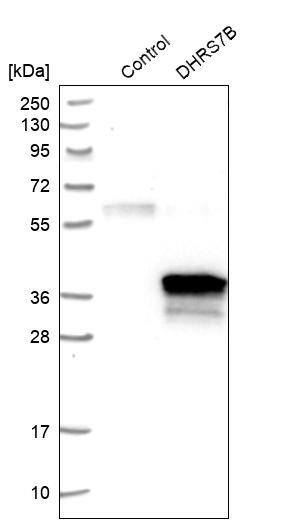 Analysis in control (vector only transfected HEK293T lysate) and DHRS7B over-expression lysate (Co-expressed with a C-terminal myc-DDK tag (~3.1 kDa) in mammalian HEK293T cells).