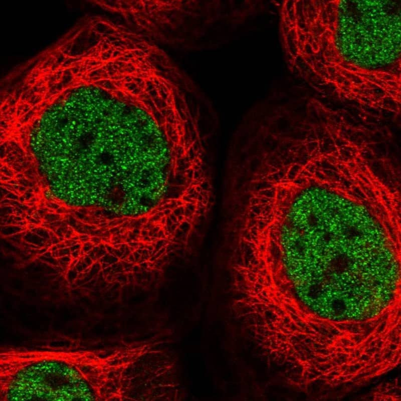 Staining of human cell line A-431 shows localization to nucleoplasm.