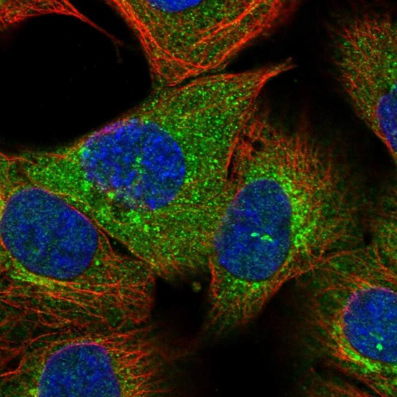 Staining of human cell line A-431 shows localization to cytosol & the Golgi apparatus.