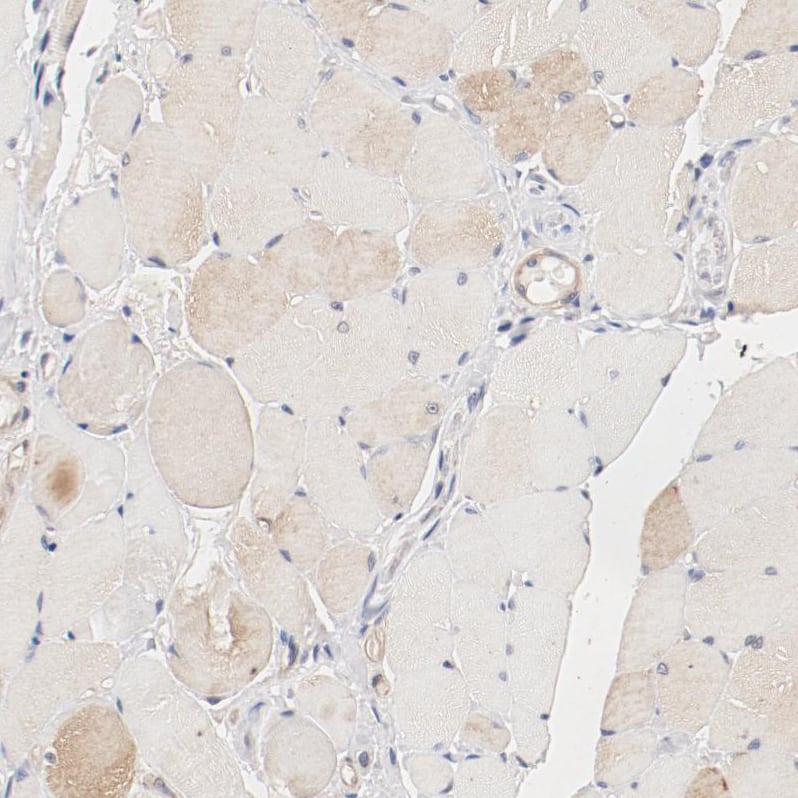 Immunohistochemistry-Paraffin UBE2J1 Antibody - BSA Free