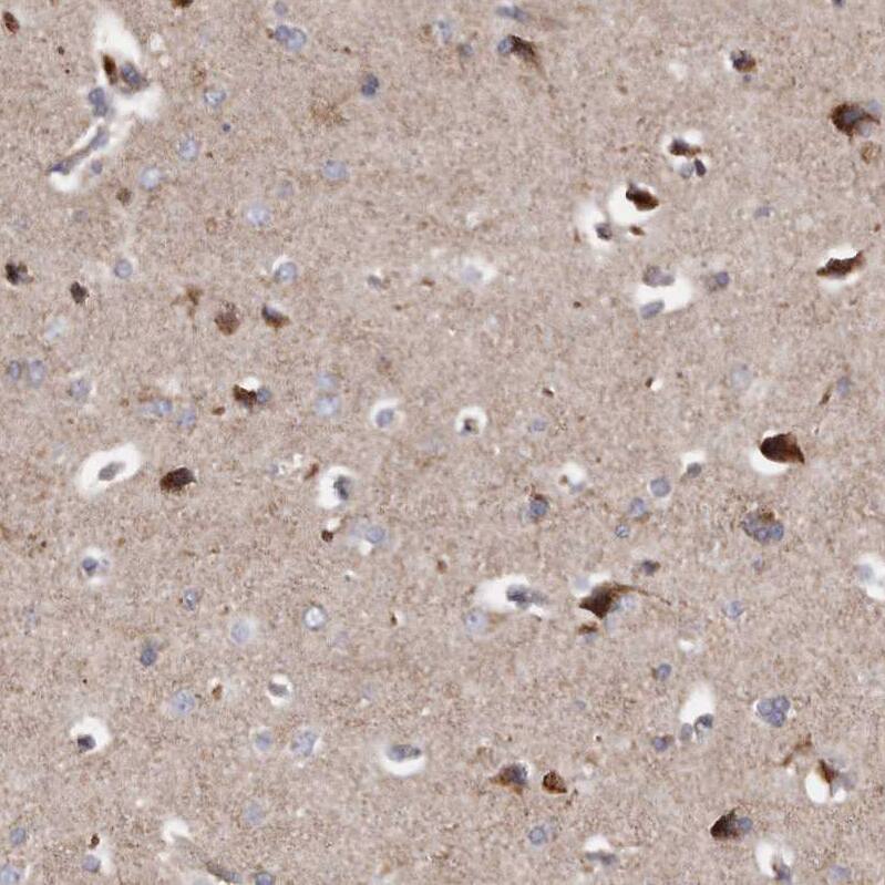 Staining of human cerebral cortex shows strong cytoplasmic positivity in neurons.