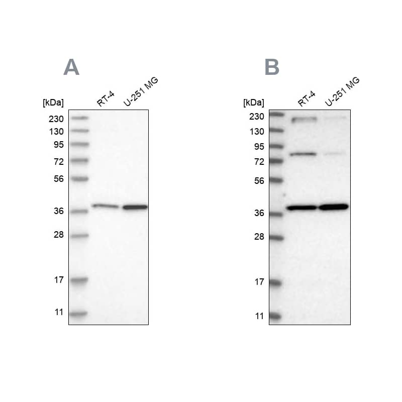 Analysis using Anti-MECR antibody NBP1-85657 (A) shows similar pattern to independent antibody NBP1-85659 (B).