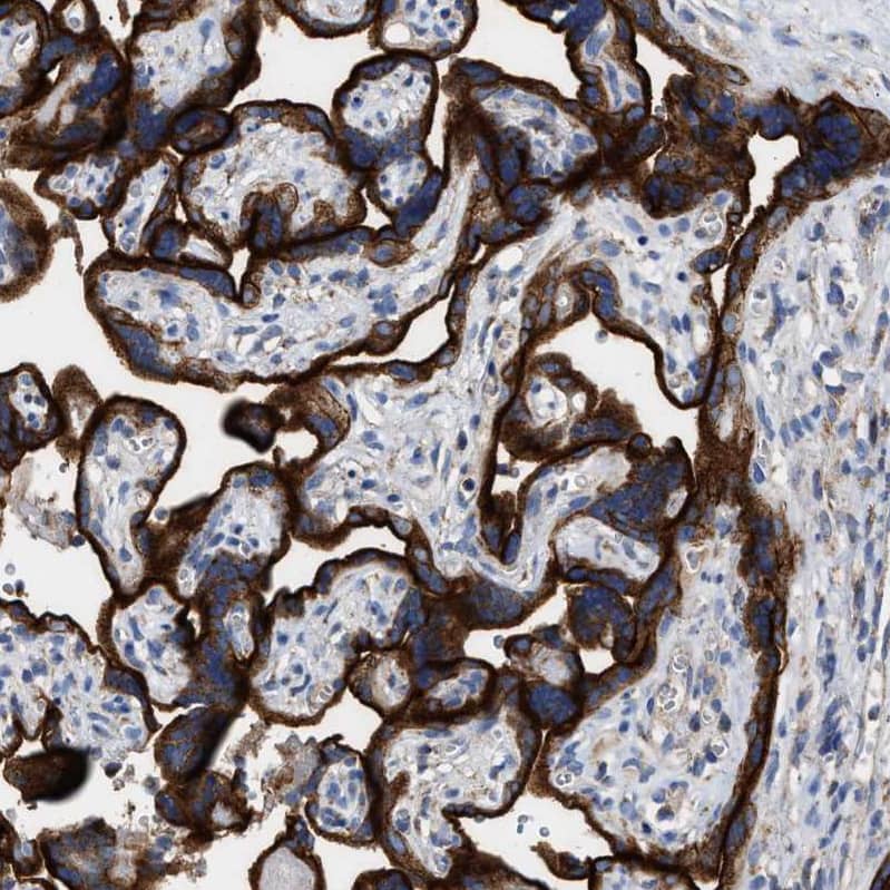 Immunohistochemistry-Paraffin MECR Antibody - BSA Free