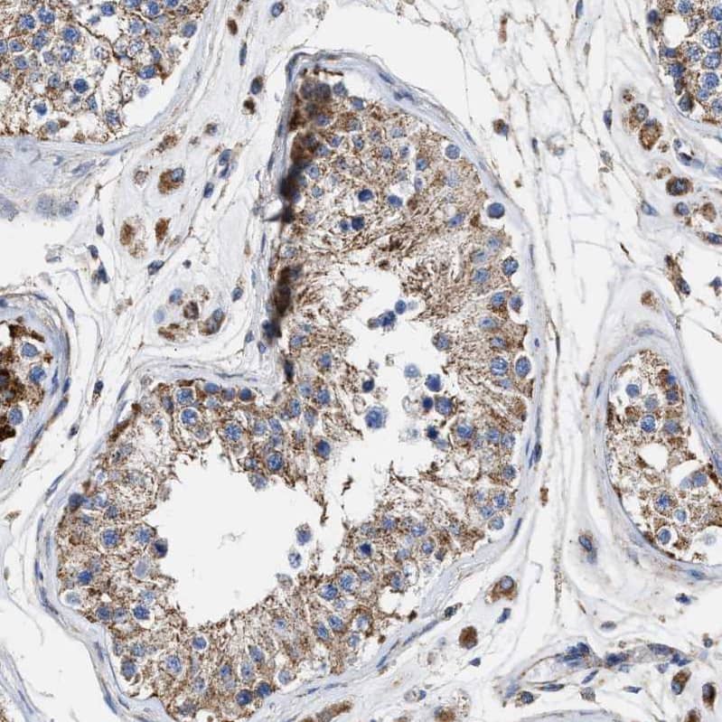 Immunohistochemistry-Paraffin MECR Antibody - BSA Free