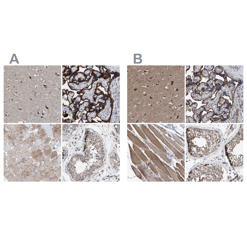 Immunohistochemistry-Paraffin MECR Antibody - BSA Free