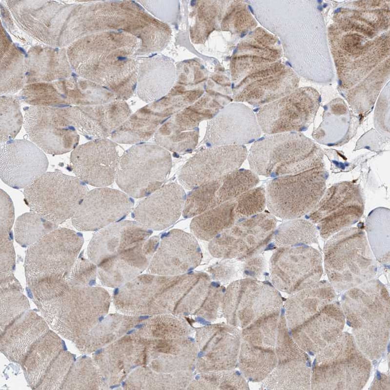 Immunohistochemistry-Paraffin MECR Antibody - BSA Free