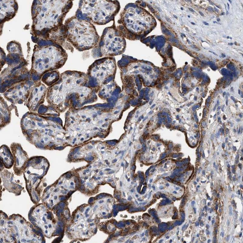 Immunohistochemistry-Paraffin MECR Antibody - BSA Free