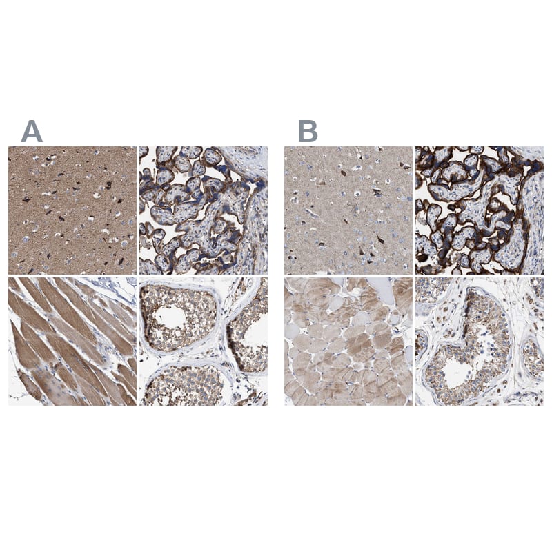Immunohistochemistry-Paraffin MECR Antibody - BSA Free