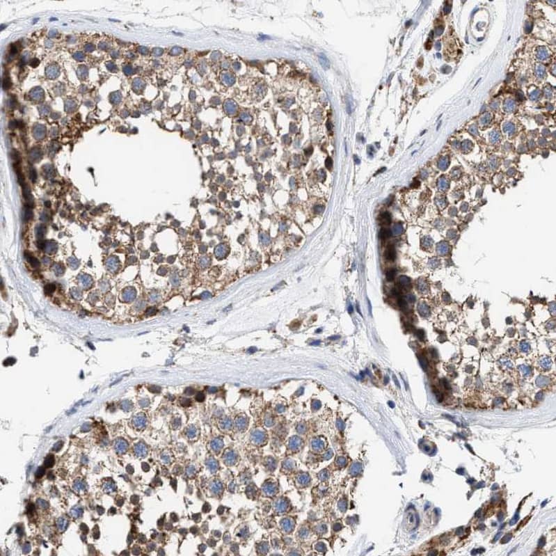 Immunohistochemistry-Paraffin MECR Antibody - BSA Free