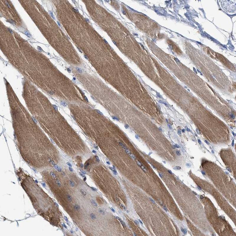 Immunohistochemistry-Paraffin MECR Antibody - BSA Free